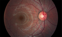 시신경촬영 검사